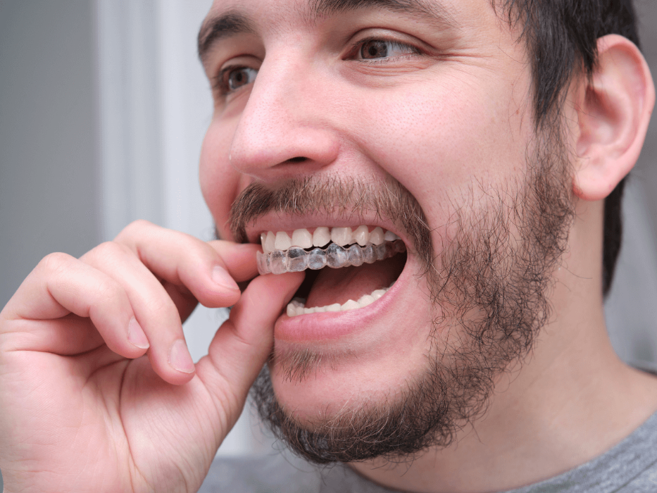 invisalign dedham | man with clear aligners