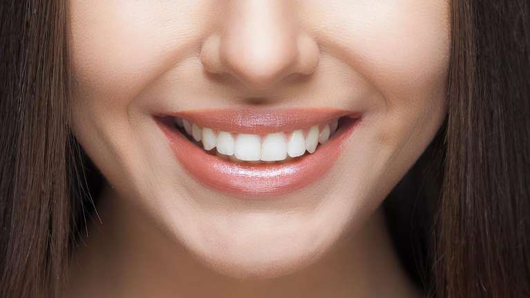 teeth whitening dedham | woman smiling